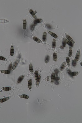 Nowe zagrożenie – grzyby rodzaju Neopestalotiopsis w uprawie truskawki